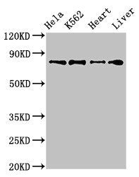 Western Blot | Positive WB detected in: Hela whole cell lysate, K562 whole cell lysate, Mouse heart tissue, Rat liver tissue | All lanes: RGL2 antibody at 3.2μg/ml | Secondary | Goat polyclonal to rabbit IgG at 1/50000 dilution | Predicted band size: 84, 51 kDa | Observed band size: 84 kDa