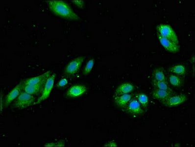 Immunofluorescent analysis of HepG2 cells using RGS19 Antibody at dilution of 1:100 and Alexa Fluor 488-congugated AffiniPure Goat Anti-Rabbit IgG(H+L)Rabbit anti-Human RGS19 Polyclonal Antibody