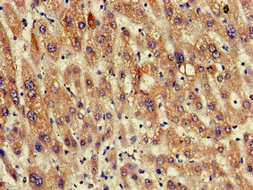 Immunohistochemistry of paraffin-embedded human liver tissue using RGS19 Antibody at dilution of 1:100Rabbit anti-Human RGS19 Polyclonal Antibody