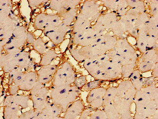 Immunohistochemistry of paraffin-embedded human heart tissue using RGS2 Antibody at dilution of 1:100Rabbit anti-Human RGS2 Polyclonal Antibody