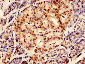 Immunohistochemistry of paraffin-embedded human pancreatic tissue using RGS2 Antibody at dilution of 1:100Rabbit anti-Human RGS2 Polyclonal Antibody