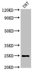 Western Blot  | Positive WB detected in: U87 whole cell lysate  | All lanes: RGS2 antibody at 3µg/ml  | Secondary  | Goat polyclonal to rabbit IgG at 1/50000 dilution  | Predicted band size: 25, 24, 23, 21 kDa  | Observed band size: 25 kDaRabbit anti-Human RGS2 Polyclonal Antibody