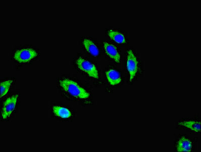 Immunofluorescent analysis of A549 cells using RGS20 Antibody at dilution of 1:100 and Alexa Fluor 488-congugated AffiniPure Goat Anti-Rabbit IgG(H+L)Rabbit anti-Human RGS20 Polyclonal Antibody