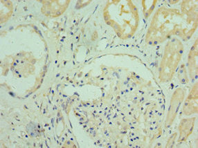 Immunohistochemistry of paraffin-embedded human kidney tissue using RGS20 Antibody at dilution of 1:100Rabbit anti-Human RGS20 Polyclonal Antibody