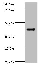 Western blot | All lanes: RGS20 antibody at 8μg/ml + Mouse brain tissue | Secondary | Goat polyclonal to rabbit IgG at 1/10000 dilution | Predicted band size: 44, 32, 22, 18, 26, 28 kDa | Observed band size: 44 kDaRabbit anti-Human RGS20 Polyclonal Antibody