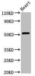Western Blot | Positive WB detected in: Rat heart tissue | All lanes: RGS6 antibody at 8μg/ml | Secondary | Goat polyclonal to rabbit IgG at 1/50000 dilution | Predicted band size: 55, 57, 54, 50, 51, 53, 52, 41, 56 kDa | Observed band size: 55 kDa
