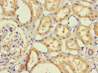 Immunohistochemistry of paraffin-embedded human kidney tissue using RHD Antibody at dilution of 1:100Rabbit anti-Human RHD Polyclonal Antibody