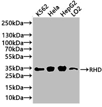 Western Blot | Positive WB detected in: Mouse liver tissue | All lanes: RHD antibody at 3μg/ml | Secondary | Goat polyclonal to rabbit IgG at 1/50000 dilution | Predicted band size: 46, 35, 54, 44, 42 kDa | Observed band size: 46 kDaRabbit anti-Human RHD Polyclonal Antibody