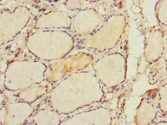 Immunohistochemistry of paraffin-embedded human thyroid tissue using RHOBTB1 Antibody at dilution of 1:100