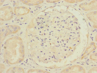 Immunohistochemistry of paraffin-embedded human kidney tissue using RHOBTB1 Antibody at dilution of 1:100