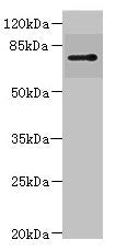 Western blot | All lanes: RHOBTB1 antibody IgG at 3.17μg/ml + 293T whole cell lysate | Secondary | Goat polyclonal to rabbit IgG at 1/10000 dilution | Predicted band size: 79 kDa | Observed band size: 79 kDa