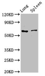 Western Blot  | Positive WB detected in: Rat lung tissue, Rat spleen tissue  | All lanes: RIPK2 antibody at 2.7µg/ml  | Secondary  | Goat polyclonal to rabbit IgG at 1/50000 dilution  | Predicted band size: 62, 46 kDa  | Observed band size: 62 kDaRabbit anti-Human RIPK2 Polyclonal Antibody