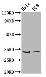 Western Blot  | Positive WB detected in: Hela whole cell lysate, PC-3 whole cell lysate  | All lanes: RNASEH1 antibody at 3.59µg/ml  | Secondary  | Goat polyclonal to rabbit IgG at 1/50000 dilution  | Predicted band size: 33 kDa  | Observed band size: 33 kDaRabbit anti-Human RNASEH1 Polyclonal Antibody