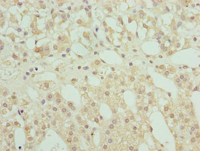 Immunohistochemistry of paraffin-embedded human adrenal gland tissue using RNF10 Antibody at dilution of 1:100Rabbit anti-Human RNF10 Polyclonal Antibody