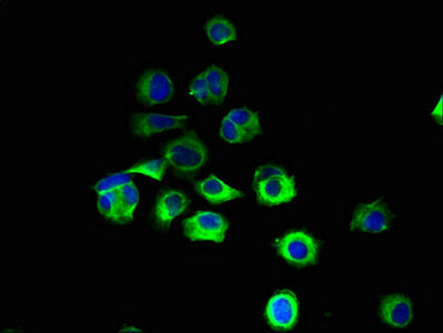 Immunofluorescent analysis of MCF-7 cells using the antibody at dilution of 1:100 and Alexa Fluor 488-congugated AffiniPure Goat Anti-Rabbit IgG(H+L)Rabbit anti-Human RNF103 Polyclonal Antibody
