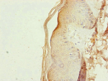 Immunohistochemistry of paraffin-embedded human skin tissue using RNF114 Antibody at dilution of 1:100Rabbit anti-Human RNF114 Polyclonal Antibody