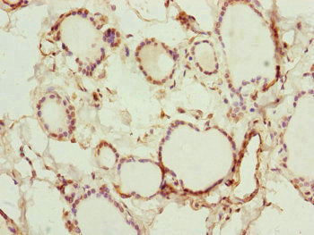 Immunohistochemistry of paraffin-embedded human thyroid tissue using RNF114 Antibody at dilution of 1:100Rabbit anti-Human RNF114 Polyclonal Antibody