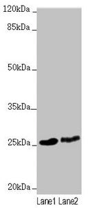 Western blot  | All lanes: RNF114 antibody at 1.63µg/ml  | Lane 1: 293T whole cell lysate  | Lane 2: HepG2 whole cell lysate  | Secondary  | Goat polyclonal to rabbit IgG at 1/10000 dilution  | Predicted band size: 26, 22 kDa  | Observed band size: 26 kDaRabbit anti-Human RNF114 Polyclonal Antibody