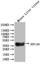 Western Blot | Positive WB detected in: Mouse brain tissue | All lanes: RNF126 antibody at 2.7μg/ml | Secondary | Goat polyclonal to rabbit IgG at 1/50000 dilution | Predicted band size: 36, 34 kDa | Observed band size: 36 kDaRabbit anti-Human RNF126 Polyclonal Antibody