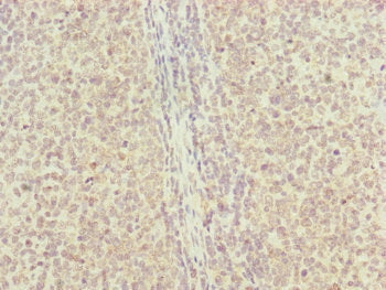 Immunohistochemistry of paraffin-embedded human tonsil tissue using RNF13 Antibody at dilution of 1:100Rabbit anti-Human RNF13 Polyclonal Antibody