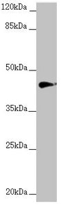Western blot  | All lanes: RNF13 antibody at 1.22µg/ml + MCF-7 whole cell lysate  | Secondary  | Goat polyclonal to rabbit IgG at 1/10000 dilution  | Predicted band size: 43, 30 kDa  | Observed band size: 43 kDaRabbit anti-Human RNF13 Polyclonal Antibody