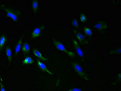 Immunofluorescent analysis of Hela cells using RNF148 Antibody at dilution of 1:100 and Alexa Fluor 488-congugated AffiniPure Goat Anti-Rabbit IgG(H+L)Rabbit anti-Human RNF148 Polyclonal Antibody