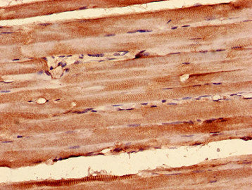 Immunocytochemistry analysis of human skeletal muscle tissue using SDHA Antibody at dilution of 1:100
