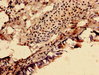 Immunocytochemistry analysis of human lung tissue using SDHA Antibody at dilution of 1:100