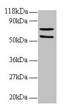 Western blot  | All lanes: SDHA antibody at 2µg/ml + 293T whole cell lysate  | Secondary  | Goat polyclonal to rabbit IgG at 1/15000 dilution  | Predicted band size: 73, 68, 57 kDa  | Observed band size: 73, 57 kDa