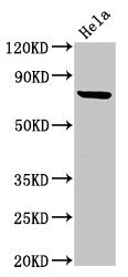 Western Blot | Positive WB detected in: Hela whole cell lysate | All lanes: RNF219 antibody at 4μg/ml | Secondary | Goat polyclonal to rabbit IgG at 1/50000 dilution | Predicted band size: 81 kDa | Observed band size: 81 kDaRabbit anti-Human RNF219 Polyclonal Antibody