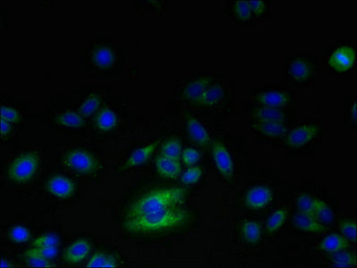 Immunofluorescent analysis of HepG2 cells using RNF24 Antibody at dilution of 1:100 and Alexa Fluor 488-congugated AffiniPure Goat Anti-Rabbit IgG(H+L)Rabbit anti-Human RNF24 Polyclonal Antibody