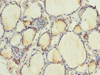 Immunohistochemistry of paraffin-embedded human thyroid tissue using the antibody at dilution of 1:100Rabbit anti-Human RNF24 Polyclonal Antibody