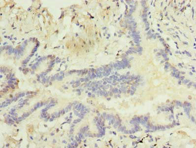 Immunohistochemistry of paraffin-embedded human lung tissue using RNF24 Antibody at dilution of 1:100Rabbit anti-Human RNF24 Polyclonal Antibody