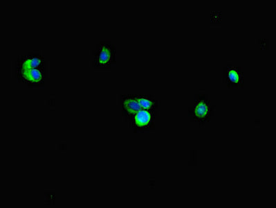Immunofluorescent analysis of HepG2 cells using RNF4 Antibody at dilution of 1:100 and Alexa Fluor 488-congugated AffiniPure Goat Anti-Rabbit IgG(H+L)Rabbit anti-Human RNF4 Polyclonal Antibody