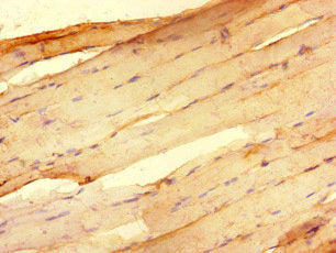 Immunohistochemistry of paraffin-embedded human skeletal muscle tissue using the antibody at dilution of 1:100Rabbit anti-Human RNF4 Polyclonal Antibody