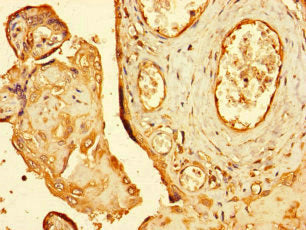 Immunohistochemistry of paraffin-embedded human placenta tissue using RNF4 Antibody at dilution of 1:100Rabbit anti-Human RNF4 Polyclonal Antibody