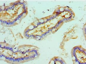 Immunohistochemistry of paraffin-embedded human small intestine tissue using ROCK2 Antibody at dilution of 1:100Rabbit anti-Human ROCK2 Polyclonal Antibody