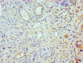 Immunohistochemistry of paraffin-embedded human kidney tissue using ROCK2 Antibody at dilution of 1:100Rabbit anti-Human ROCK2 Polyclonal Antibody