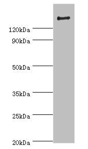 Western blot | All lanes: ROCK2 antibody at 2μg/ml + Rat brain tissue | Secondary | Goat polyclonal to rabbit IgG at 1/10000 dilution | Predicted band size: 161 kDa | Observed band size: 161 kDaRabbit anti-Human ROCK2 Polyclonal Antibody