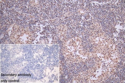 IHC image of PTBP3 Antibody diluted at 1:100 and staining in paraffin-embedded human kidney tissue performed on a Leica BondTM system. After dewaxing and hydration, antigen retrieval was mediated by high pressure in a citrate buffer (pH 6.0). Section was blocked with 10% normal goat serum 30min at RT. Then primary antibody (1% BSA) was incubated at 4°C overnight. The primary is detected by a biotinylated secondary antibody and visualized using an HRP conjugated SP system.Rabbit anti-Human PTBP3 Polyclonal Antibody