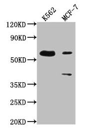 Western Blot  | Positive WB detected in: K562 whole cell lysate, MCF-7 whole cell lysate  | All lanes: PTBP3 antibody at 1:2000  | Secondary  | Goat polyclonal to rabbit IgG at 1/50000 dilution  | Predicted band size: 60, 57, 61, 50 kDa  | Observed band size: 60 kDaRabbit anti-Human PTBP3 Polyclonal Antibody