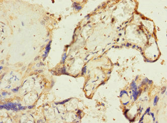 Immunohistochemistry of paraffin-embedded human placenta tissue using RPIA Antibody at dilution of 1:100Rabbit anti-Human RPIA Polyclonal Antibody