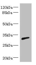 Western blot | All lanes: RPIA antibody IgG at 3.29μg/ml + Mouse kidney tissue | Secondary | Goat polyclonal to rabbit IgG at 1/10000 dilution | Predicted band size: 33 kDa | Observed band size: 33 kDaRabbit anti-Human RPIA Polyclonal Antibody