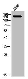 Western Blot analysis of A549 cells using NOS3 Polyclonal AntibodyRabbit anti-Human NOS3 Polyclonal Antibody