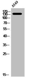 Western Blot analysis of A549 cells using NOS3 Polyclonal AntibodyRabbit anti-Human NOS3 Polyclonal Antibody