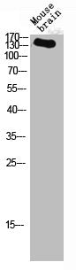 Western blot analysis of mouse-brain lysis using NOS3 antibody.Rabbit anti-Human NOS3 Polyclonal Antibody