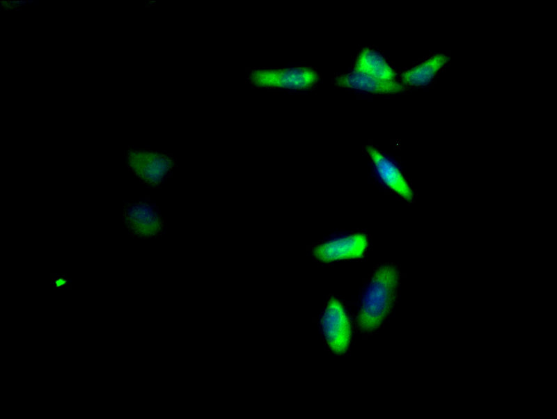 Immunofluorescent analysis of  Hela cells using RPL19 Antibody at dilution of 1:100 and Alexa Fluor 488-congugated AffiniPure Goat Anti-Rabbit IgG(H+L)Rabbit anti-Human RPL19 Polyclonal Antibody