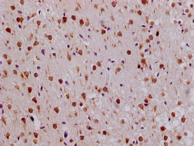Immunohistochemistry of paraffin-embedded human brain tissue using the antibody PA020160LA01HU at dilution of 1:100Rabbit anti-Human RPL19 Polyclonal Antibody