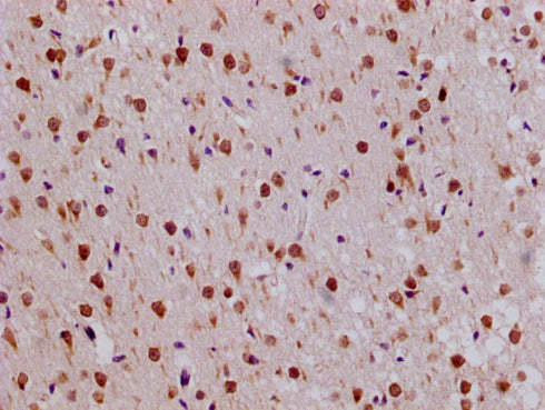 Immunohistochemistry of paraffin-embedded human brain tissue using the antibody PA020160LA01HU at dilution of 1:100Rabbit anti-Human RPL19 Polyclonal Antibody