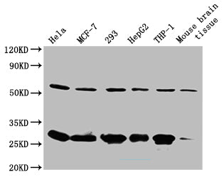 Western Blot Positive WB detected in: Hela whole cell lysate, MCF-7 whole cell lysate, 293 whole cell lysate, HepG2 whole cell lysate, THP-1 whole cell lysate, Mouse brain tissue All lanes: TMEM65 antibody at 1:500  Secondary Goat polyclonal to rabbit IgG at 1/50000 dilution Predicted band size: 24, 28 KDa Observed band size: 28, 56 KDa Exposure time: 5minRabbit anti-Human RPL19 Polyclonal Antibody